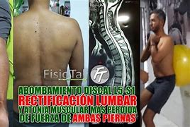 Image result for ablmbamiento