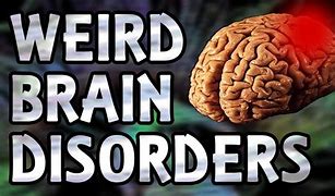 Image result for Weird Brain