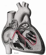Image result for Bundle Branch Heart