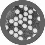 Image result for Poliovirus