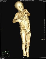 Image result for Pompeii Mummified Bodies