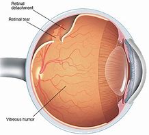 Image result for Peripheral Retina