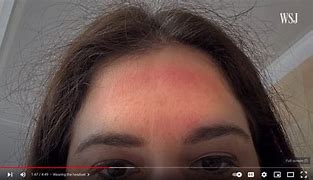 Image result for VR Headset Marks On Face