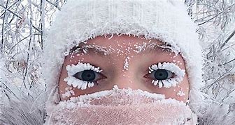 Image result for Russia Cold