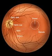 Image result for Normal Eye Retina