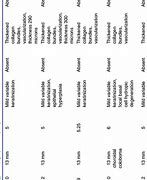 Image result for Congenital Microcephaly