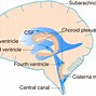 Image result for Choroid Plexus 4th Ventricle