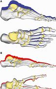 Image result for Arch in Chimpanzee Foot