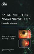 Image result for co_to_za_zapalenie_błony_naczyniowej_oka