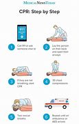 Image result for Recover Guidelines CPR