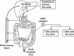 Image result for Ibat Bile Acid