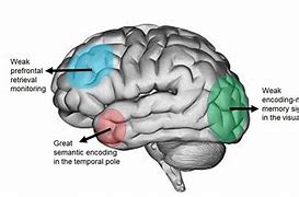 Image result for False Memory Examples