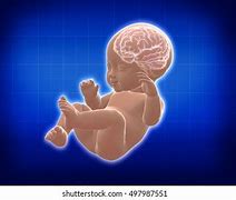 Image result for Baby X-ray Brain Clear