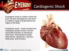 Image result for Cardiogenic Shock PPT