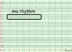 Image result for Ciganek EEG