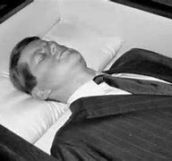 Image result for President Kennedy at Parkland Hospital