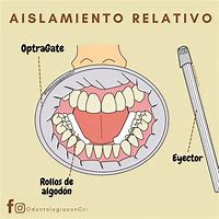 Image result for absolito