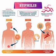 Image result for Syphilis Transmission