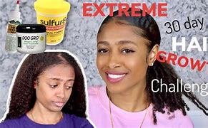 Image result for Sulfur 8 Hair Growth