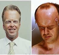 Image result for The Person That Has the Biggest Head in the World
