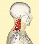 Image result for C4 C5 Spine