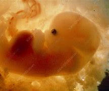Image result for 12 Week Human Embryo Ultrasound