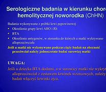 choroba_hemolityczna_noworodka 的图像结果