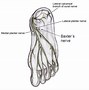 Image result for Plantar Foot Pain