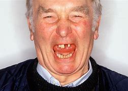 Image result for Ugly Teeth Smile