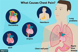 Image result for Sharp Chest Pain