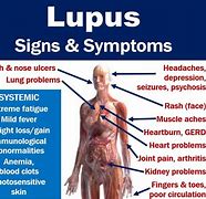 Image result for Stages of Lupus