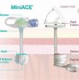 Image result for Invasiveness of Surgical Procedures
