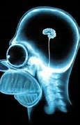 Image result for Incredible Shrinking Brain