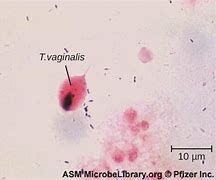 Image result for Trichomoniasis Pathogen