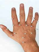 Image result for Hand Acupuncture