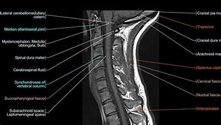 Image result for Cervical Spine Illustration