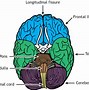 Image result for Human Brain Dissection