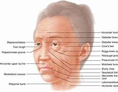 Image result for Face Cheek Anatomy