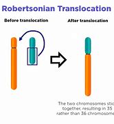 Image result for Chromosome Translocation