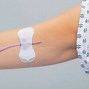 Image result for PICC Line Securement Device