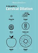 Image result for Baby Dilation Chart