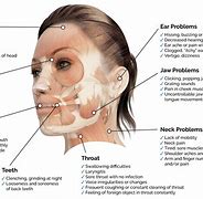 Image result for Top Jaw Bone