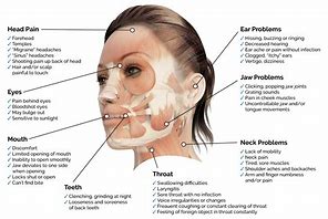 Image result for Jaw Pain Areas