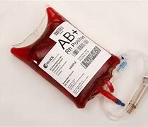 Image result for Blood Bag Sample