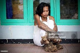Image result for Tree Man Indonesia