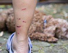 Image result for Raccoon Bite Marks