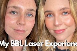 Image result for Laser Beam YouTube Face