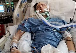 Image result for Accident Patients in Hospital