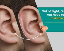 Image result for Invisible Hearing Aids Implant