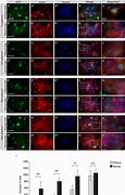 Image result for actin�grafp